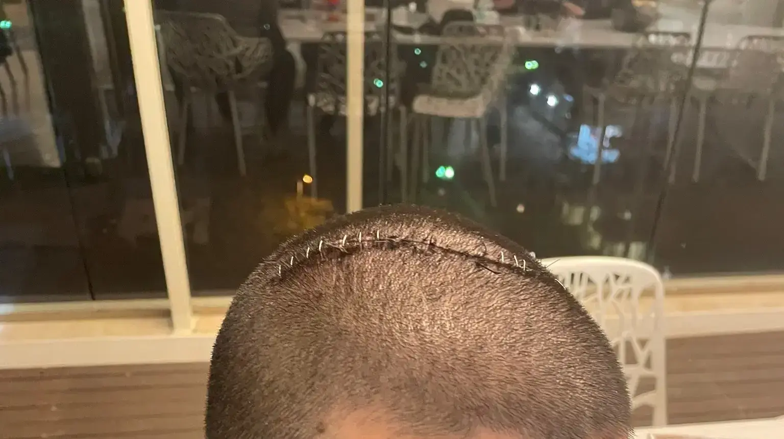 החייל שהותקף לאחר שהפריד בקטטה ברמת אביב. ינואר 2023 החייל שהותקף לאחר שהפריד בקטטה ברמת אביב. ינואר 2023