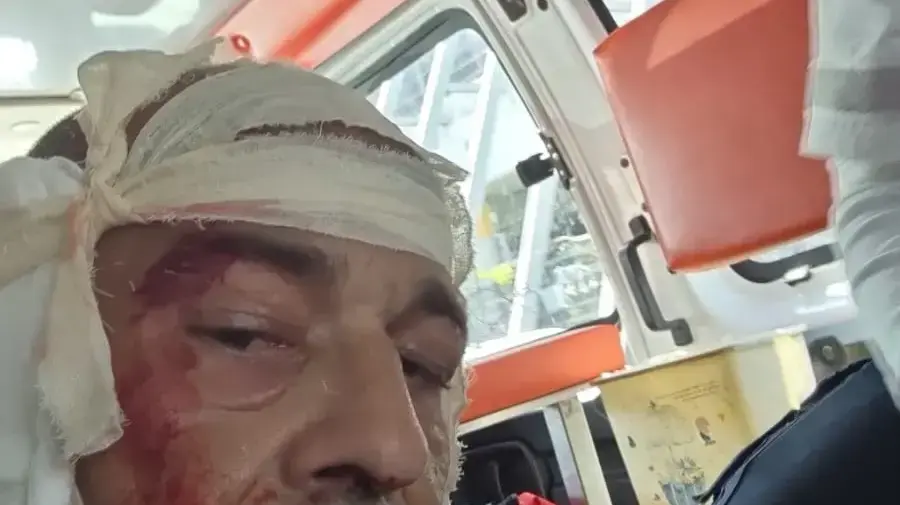 המפגין שחר מור נפצע באוזן מרימון הלם שהושלך לעבר המפגינים בתל אביב. 04 במרץ 2023