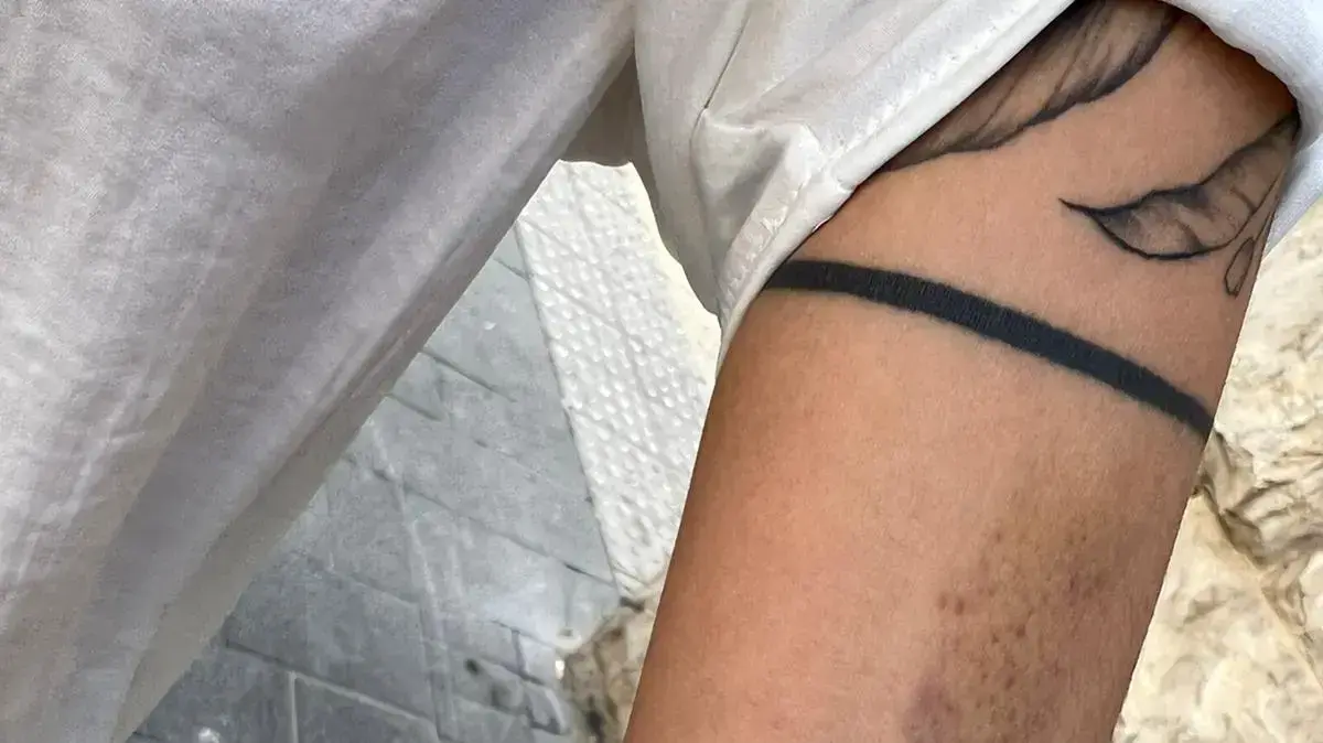 צעירה ממזרח ירושלים הותקפה לאחר שנחשדה כיהודייה. 2 במרץ 2023 צעירה ממזרח ירושלים הותקפה לאחר שנחשדה כיהודייה. 2 במרץ 2023