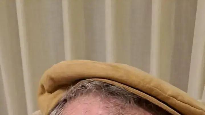 גיל אלכסנדר,נפגע מאבן בראש במהלך הפגנה נגד המהפכה המשפטית, צומת עין הנצי"ב, 25 במרץ 2023 גיל אלכסנדר,נפגע מאבן בראש במהלך הפגנה נגד המהפכה המשפטית, צומת עין הנצי"ב, 25 במרץ 2023
