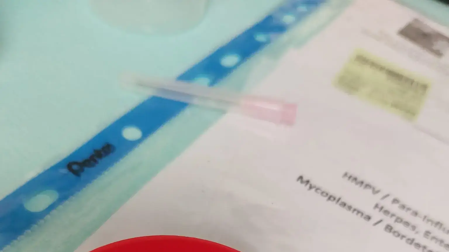ילד שאף חלק מצפצפה וטופל בבית חולים ילד שאף חלק מצפצפה וטופל בבית חולים
