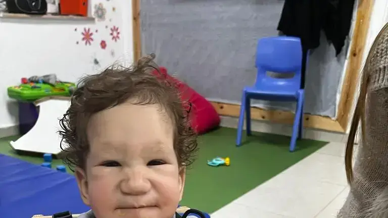 הילדה זיו מטופלת במעון יום שיקומי הילדה זיו מטופלת במעון יום שיקומי
