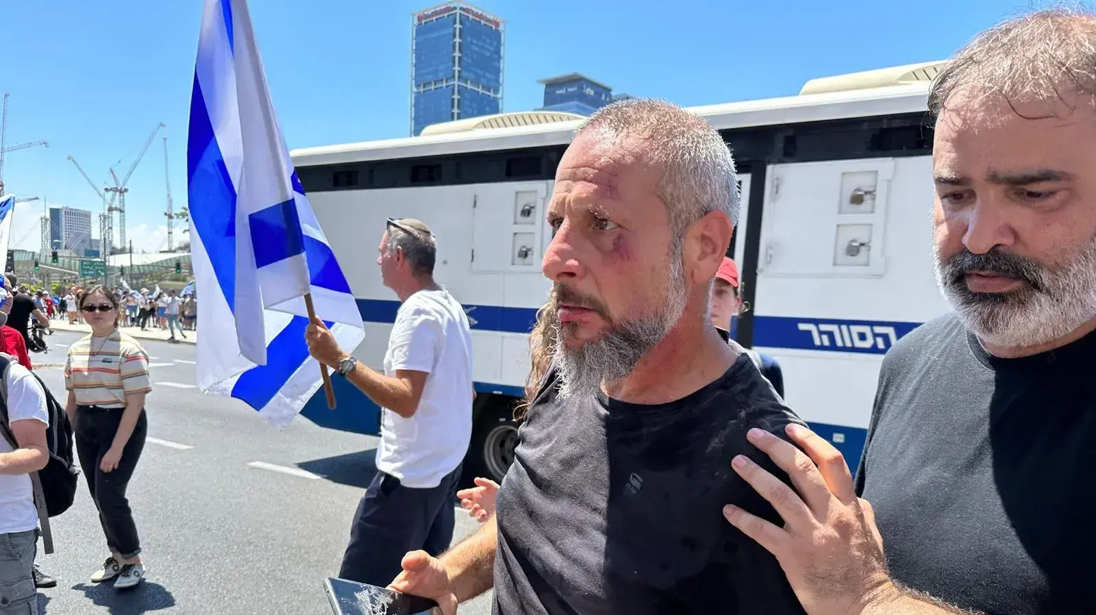 מפגין נפצע בפניו במהלך הפגנה נגד המהפכה המשפטית, תל אביב. 11 ביולי 2023 מפגין נפצע בפניו במהלך הפגנה נגד המהפכה המשפטית, תל אביב. 11 ביולי 2023