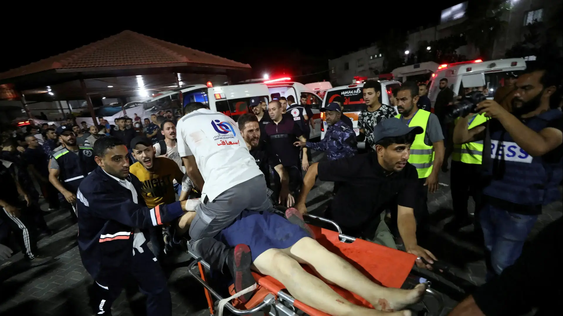 בית החולים שיפא לאחר פיצוץ בבית החולים אל-אהלי בעזה בית החולים שיפא לאחר פיצוץ בבית החולים אל-אהלי בעזה