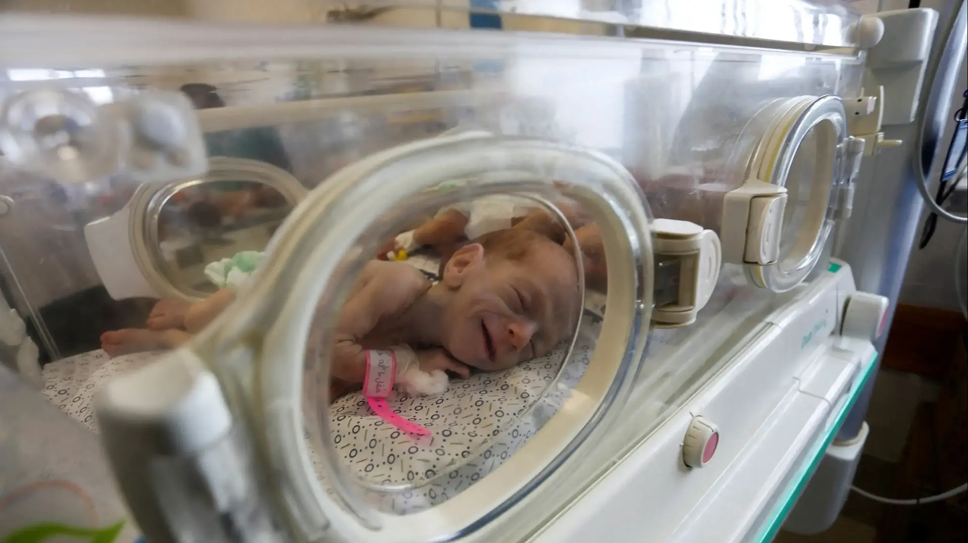 פגים שהועברו מבית החולים שיפא אל בית חולים בעיר רפיח שבדרום רצועת עזה, 19 בנובמבר 2023 פגים שהועברו מבית החולים שיפא אל בית חולים בעיר רפיח שבדרום רצועת עזה, 19 בנובמבר 2023
