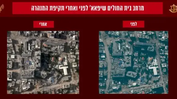 תצלום אוויר של בית החולים שיפא לפני ואחרי השמדת תוואי המנהרה תצלום אוויר של בית החולים שיפא לפני ואחרי השמדת תוואי המנהרה