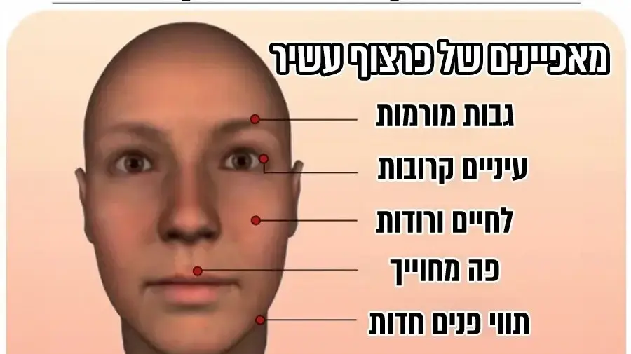 מאפייני פרצוף עשיר לעומת פרצוף עני מאפייני פרצוף עשיר לעומת פרצוף עני