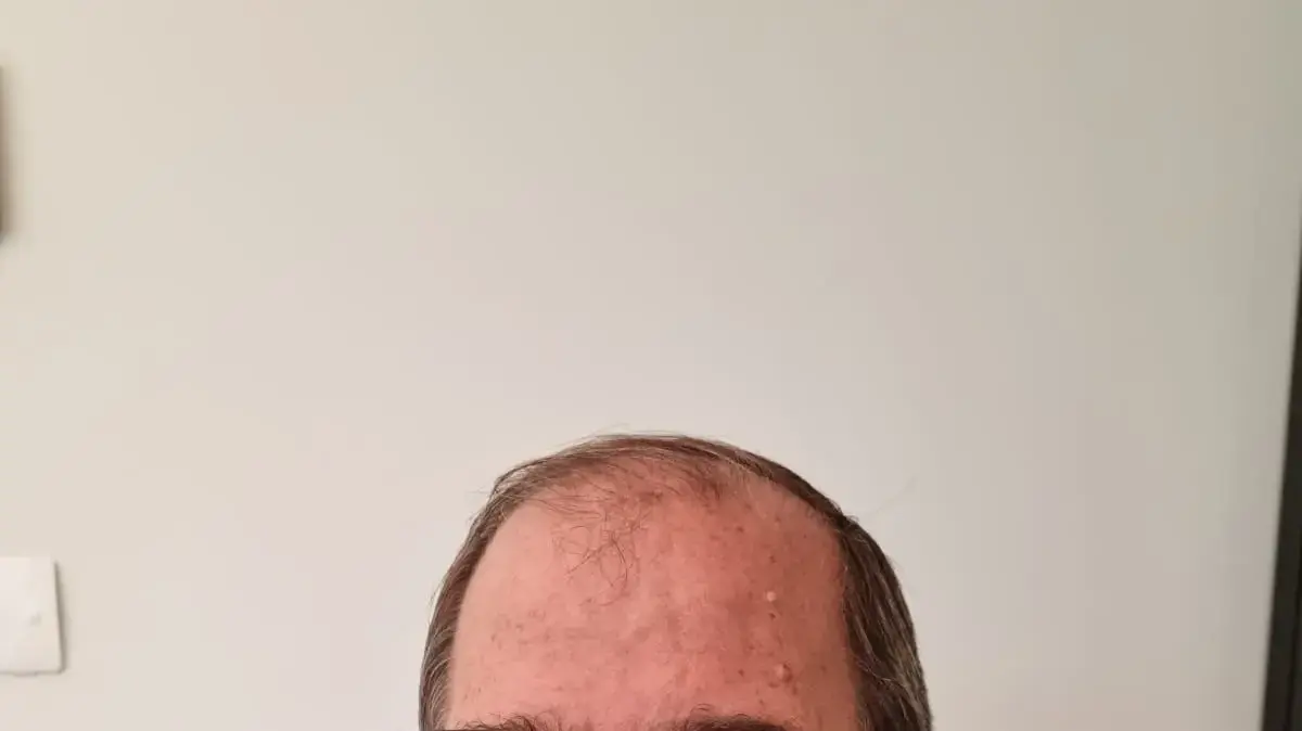 צחי גנור צחי גנור