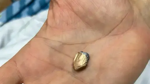 כדור שפגע ברכבו של פצוע מהפיגעו בצומת ראם כדור שפגע ברכבו של פצוע מהפיגעו בצומת ראם