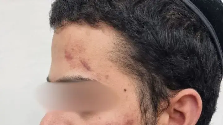 נתן גליק לאחר שהוכה במאסר נתן גליק לאחר שהוכה במאסר