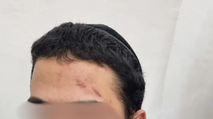 נתן גליק לאחר שהוכה במאסר נתן גליק לאחר שהוכה במאסר