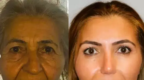 ניתוח פלסטי ניתוח פלסטי