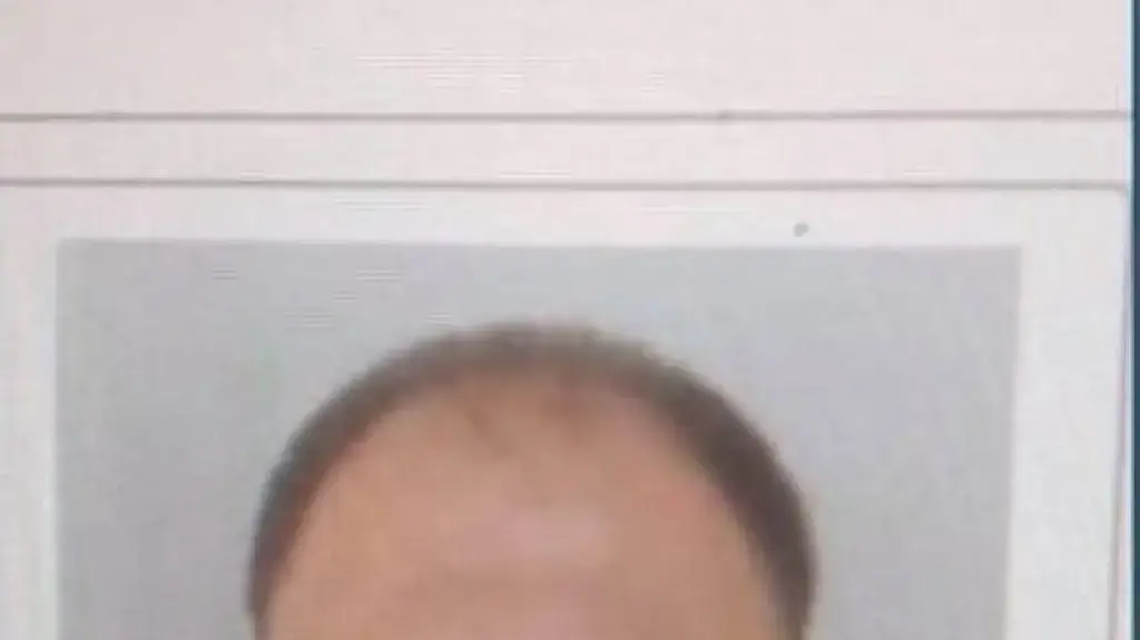התוקף בפיגוע החץ וקשת בסרביה התוקף בפיגוע החץ וקשת בסרביה