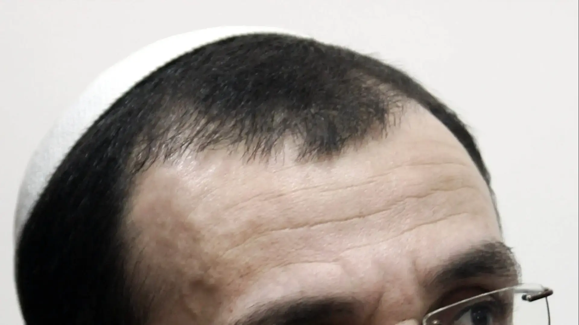 אלי אריש אלי אריש