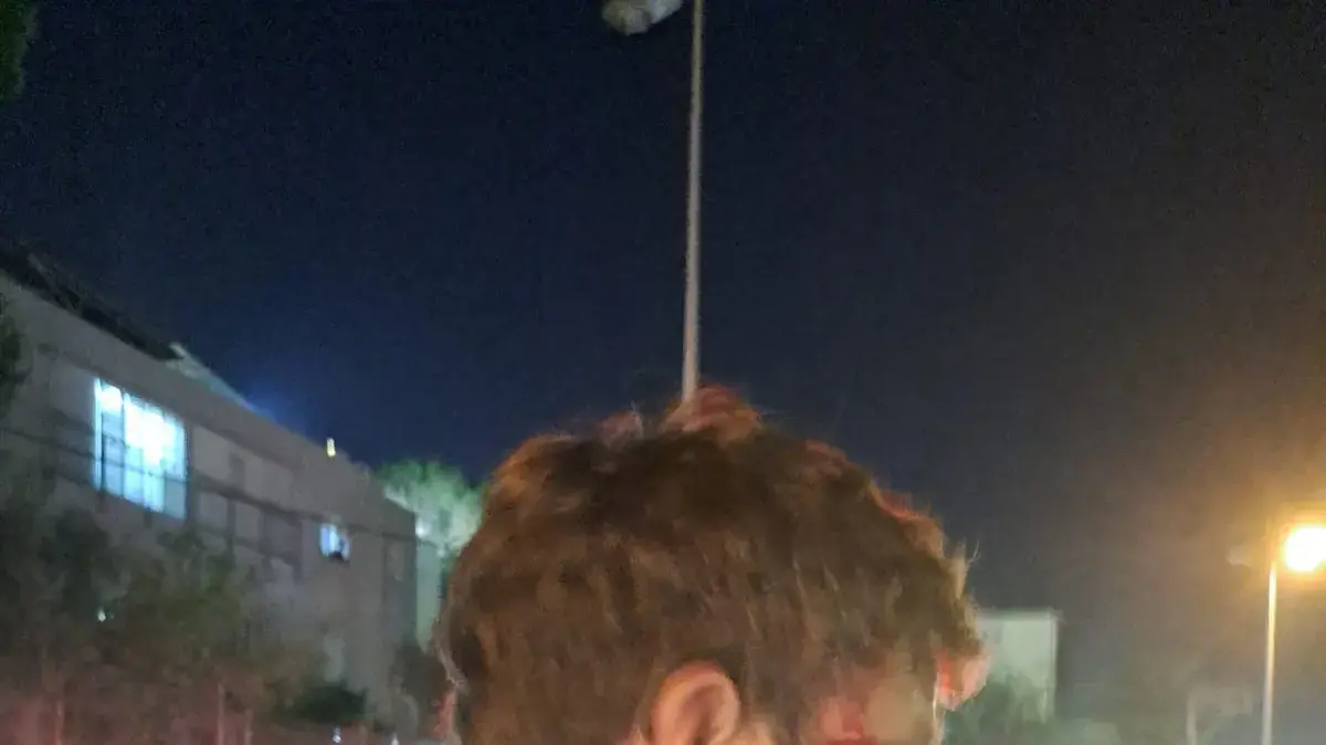 מפגין נפצע בפניו בעימות עם שוטרים בהפגנה בחיפה מפגין נפצע בפניו בעימות עם שוטרים בהפגנה בחיפה