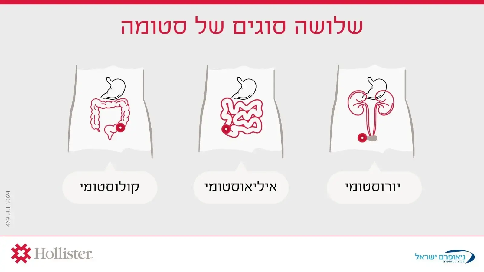 שלושת סוגי הסטומה שלושת סוגי הסטומה