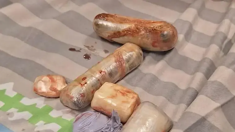 סמים שהוחבאו בתוך גופו של אדם בנסיון להכניסם אל תוך הכלא, באר שבע, דצמבר 2024 סמים שהוחבאו בתוך גופו של אדם בנסיון להכניסם אל תוך הכלא, באר שבע, דצמבר 2024