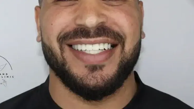 שיניים שיניים