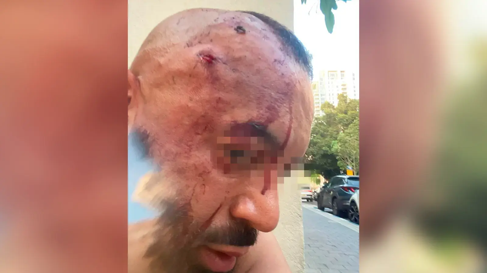 ישראל בראון, שליח על קטנוע שהותקף בת"א ישראל בראון, שליח על קטנוע שהותקף בת"א
