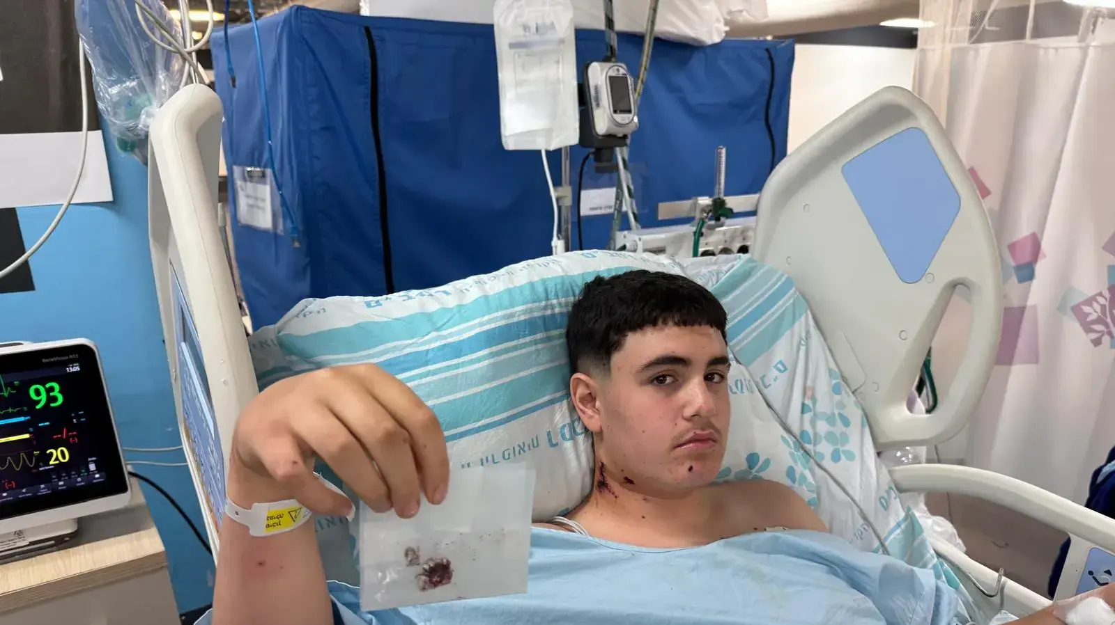 איתי מייסון, נפצע מרסיסים מפגיעת הטיל האיראני בחיפה. 20.6.2025