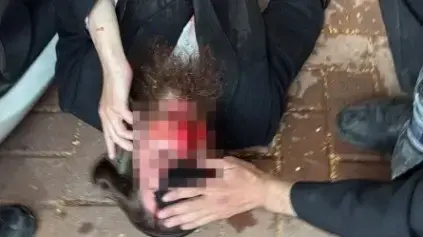 מפגינים חרדים קיצוניים ביהוד מפגינים חרדים קיצוניים ביהוד