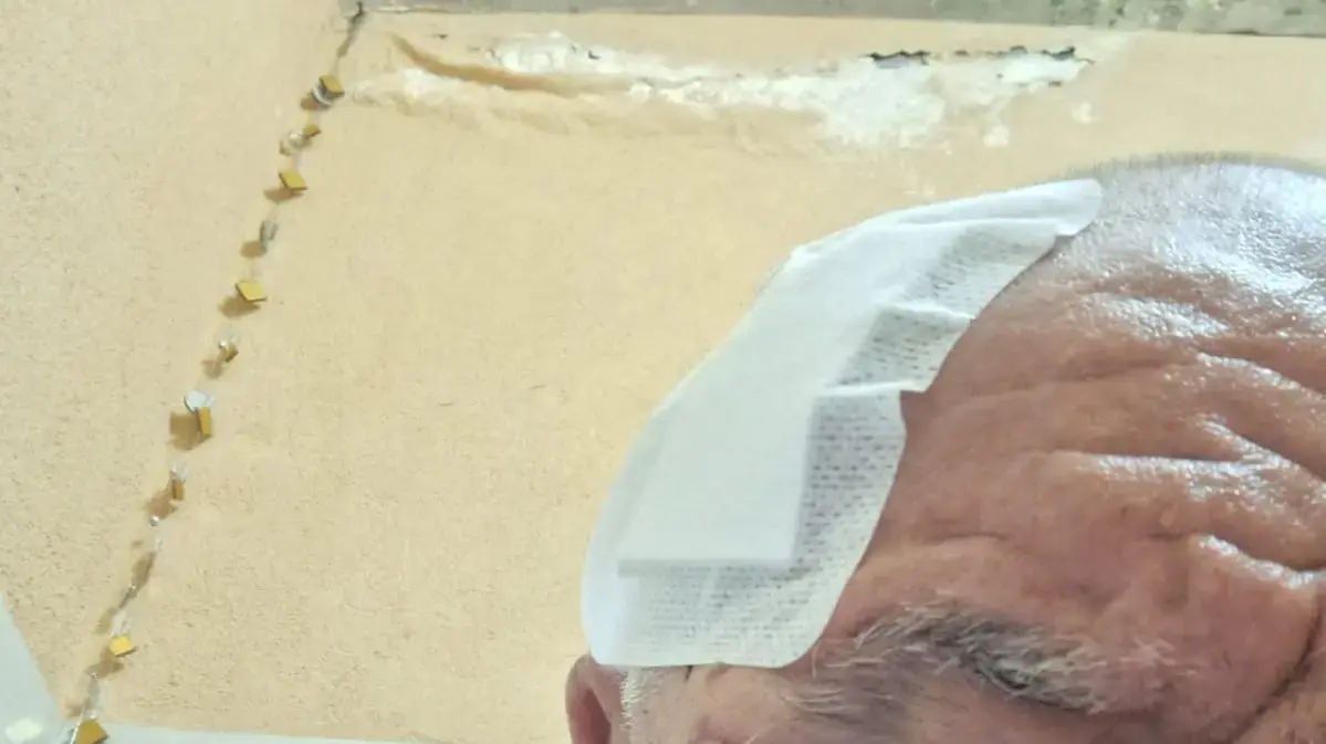 אדם הותקף באיילון אחרי שהעיר לרוכב קטנוע אדם הותקף באיילון אחרי שהעיר לרוכב קטנוע