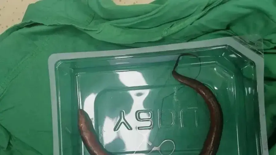 הצלופח שהוצא מהגבר הצלופח שהוצא מהגבר