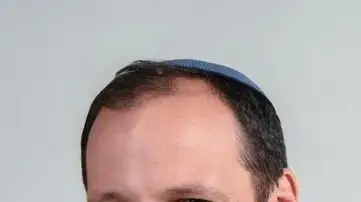 ד"ר יונתן דמה ד"ר יונתן דמה