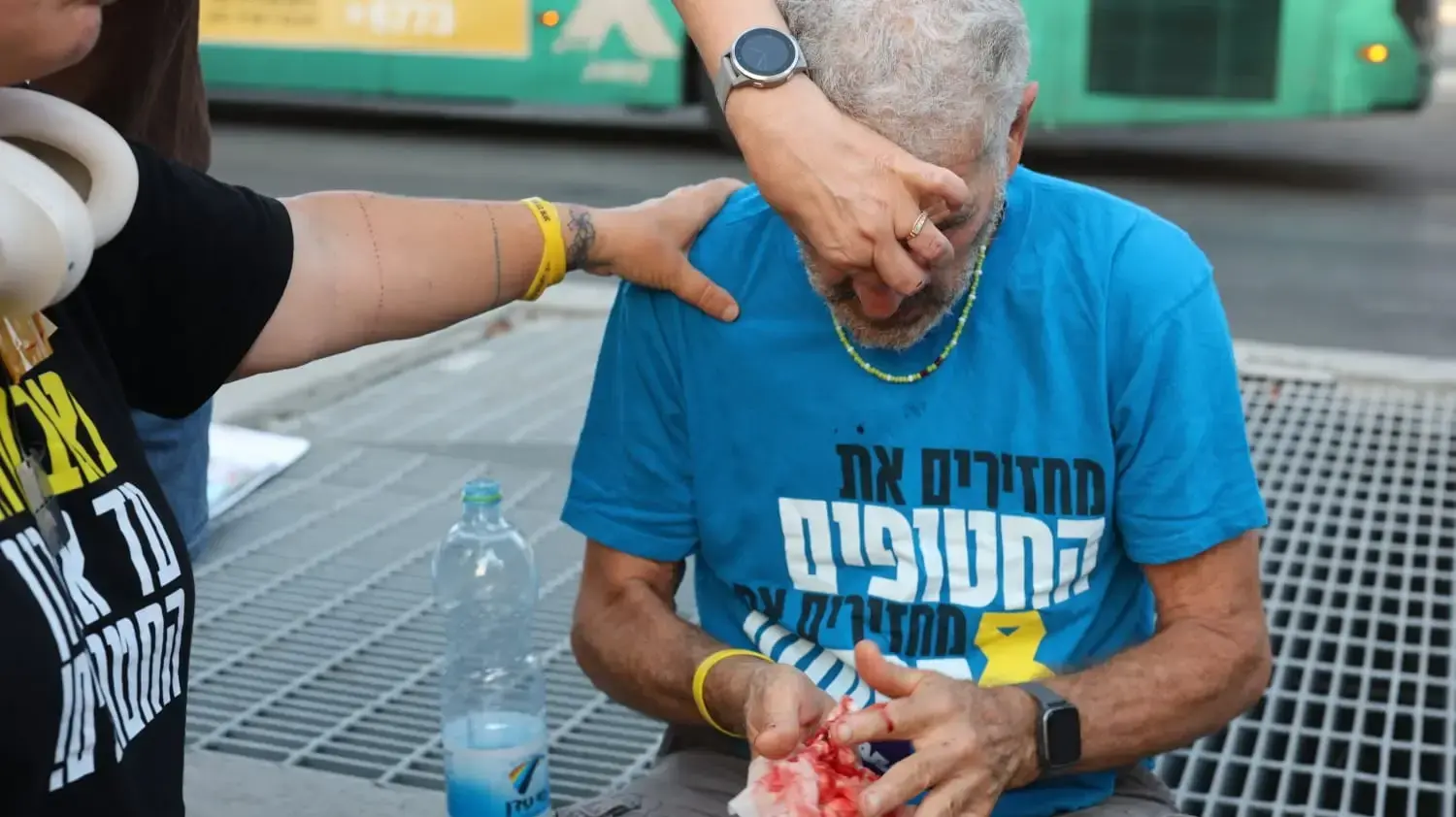 מפגין בן 74 שהותקף בפניו בידי רוכב אופנוע בהפגנה בשער בגין, תל אביב, 21 ביולי 2025