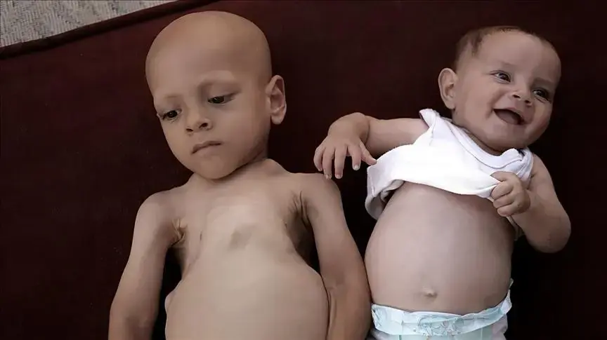 מצורפות תמונותיו של הילד עבדאללה האני מחמד אבו זרקה שפורסמו ברשתות החברתיות מצורפות תמונותיו של הילד עבדאללה האני מחמד אבו זרקה שפורסמו ברשתות החברתיות