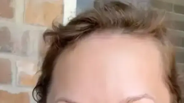 מישל ווד אחרי הניתוחים מישל ווד אחרי הניתוחים