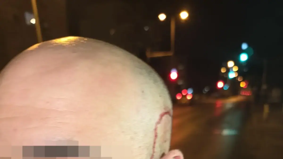 אם ובנה הותקפו קשות על ידי שכניהם בפתח תקווה