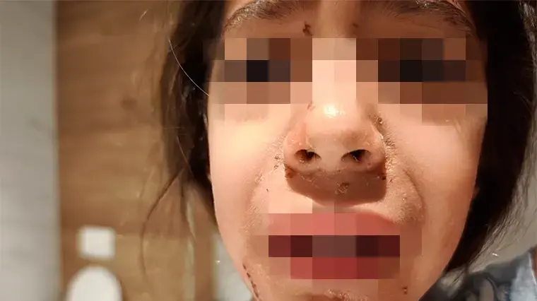 הילדה שהוכתה בגן בקריית טבעון הילדה שהוכתה בגן בקריית טבעון