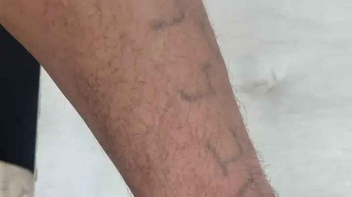 חשוד בגניבת אופנוע, על פי החשד הוכה על ידי שוטרים חשוד בגניבת אופנוע, על פי החשד הוכה על ידי שוטרים