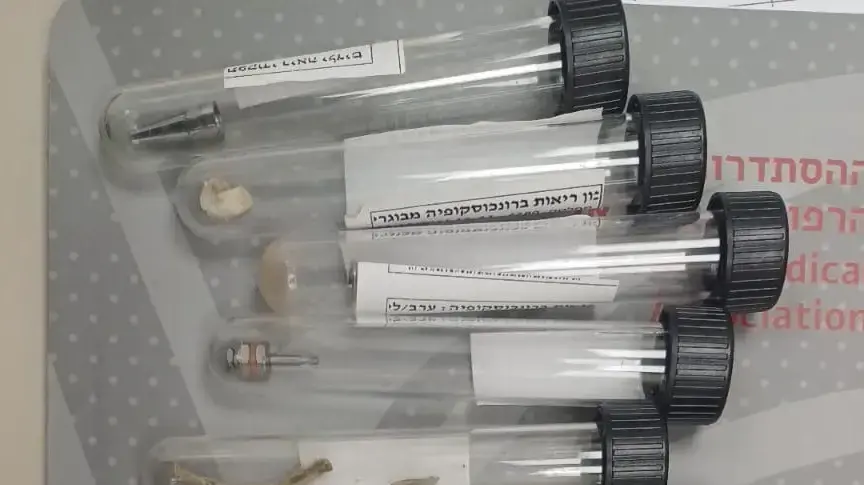 חפצים שהוצאו מגופם של מבוגרים בשערי צדק חפצים שהוצאו מגופם של מבוגרים בשערי צדק