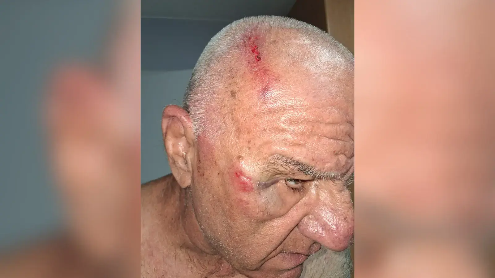 גבר מבוגר הותקף באיילון אחרי שהעיר לרוכב קטנוע