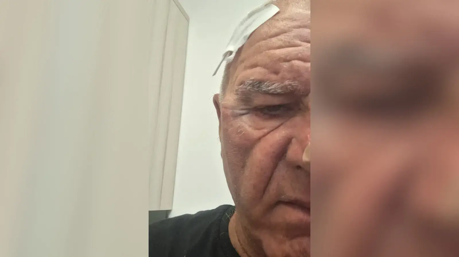 גבר מבוגר הותקף באיילון אחרי שהעיר לרוכב קטנוע גבר מבוגר הותקף באיילון אחרי שהעיר לרוכב קטנוע