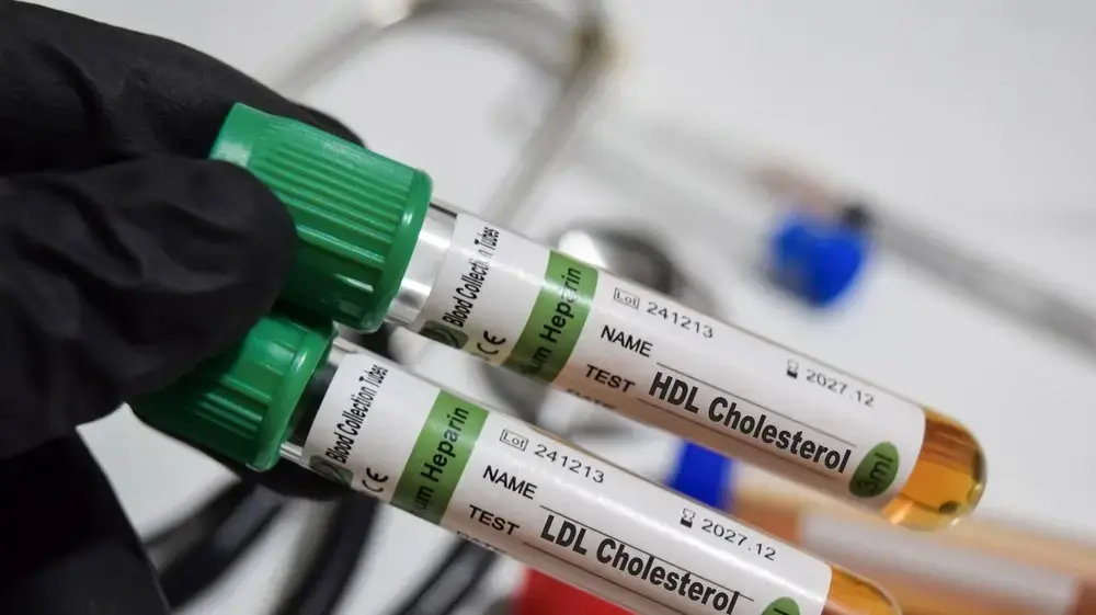 HDL LDL כולסטרול HDL LDL כולסטרול