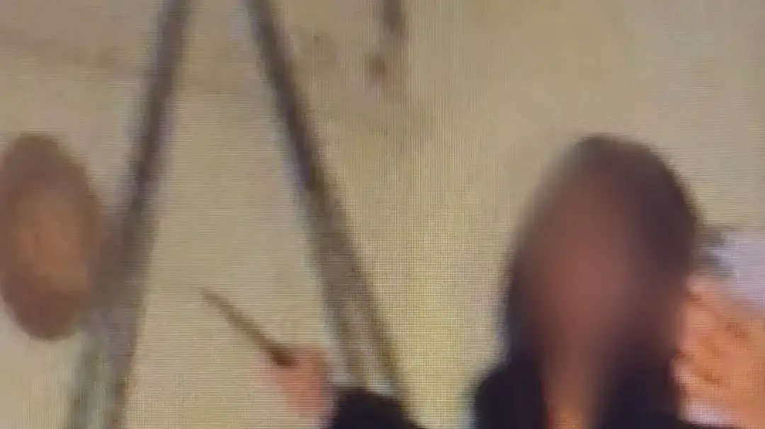 תושבת העיר ירושלים איימה על בן זוגה, דקרה אותו באמצעות סכינים וגרמה לו לחבלות קשות