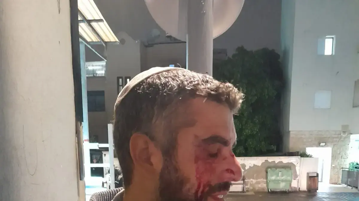 רב הותקף באלימות ביפו והוכה באגרוף, משקפיו נשברו והוא הובהל לבית החולים רב הותקף באלימות ביפו והוכה באגרוף, משקפיו נשברו והוא הובהל לבית החולים
