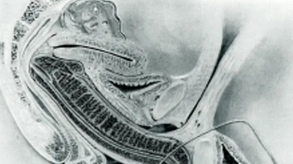 סקס בתוך MRI חשף - הווגינה לא ישרה כפי שחשבו קודם לכן סקס בתוך MRI חשף - הווגינה לא ישרה כפי שחשבו קודם לכן