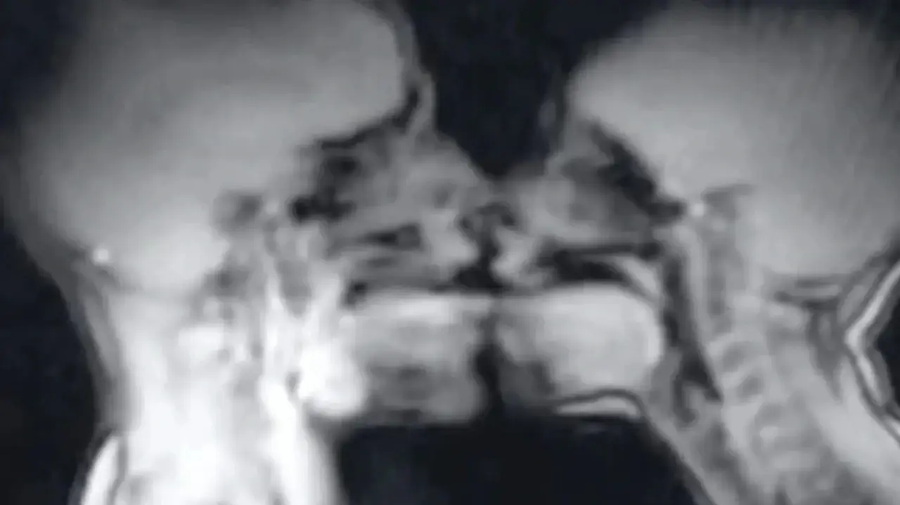 מבט מבפנים: כך נראה סקס בסריקת MRI