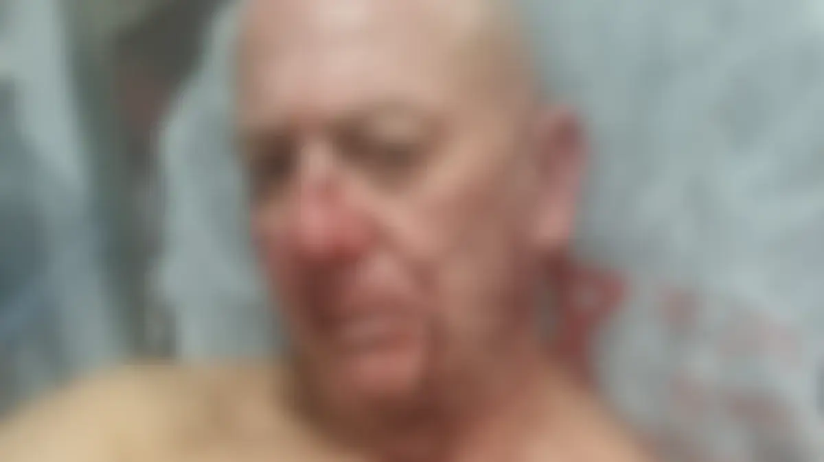 שכן ארב בכניסה לדירה ותקף תושב תל אביב באכזריות
