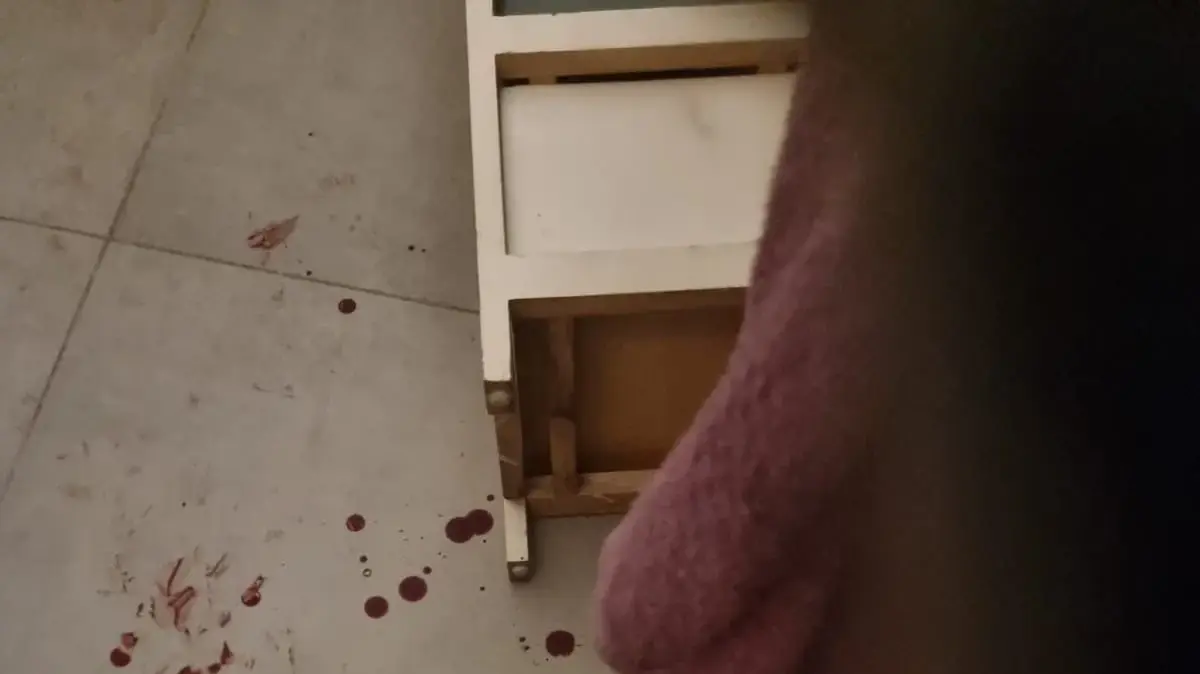 שכן ארב בכניסה לדירה ותקף תושב תל אביב באכזריות שכן ארב בכניסה לדירה ותקף תושב תל אביב באכזריות