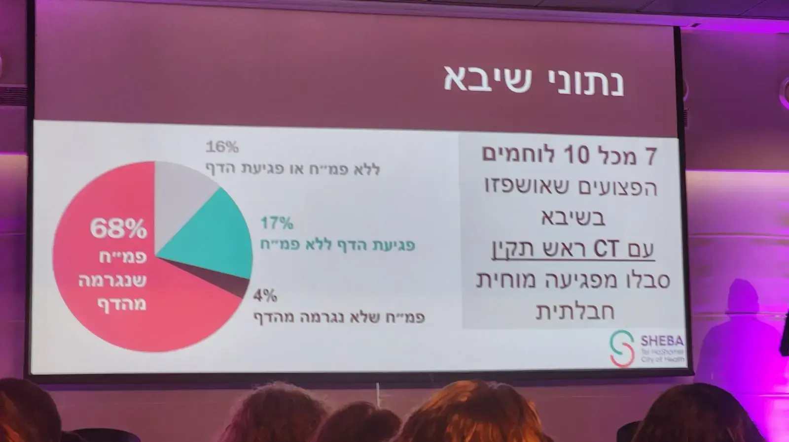 נתוני שיבא, צילום CT ראש נתוני שיבא, צילום CT ראש