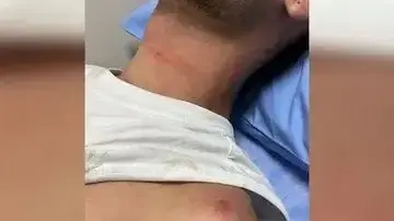 ישראלים הותקפו בקוסמוי, תאילנד