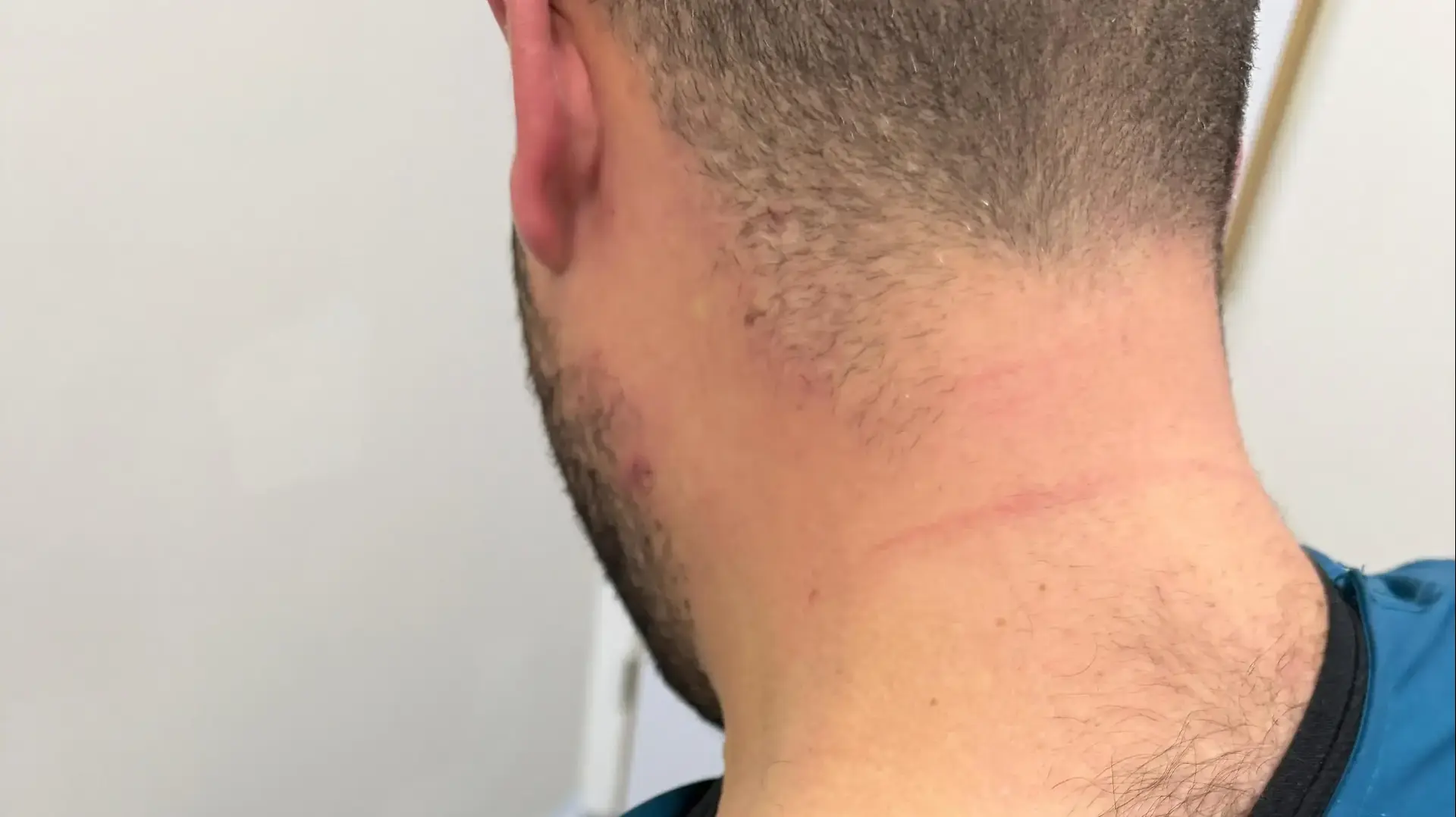 רופא הותקף ע"י מטופל רופא הותקף ע"י מטופל