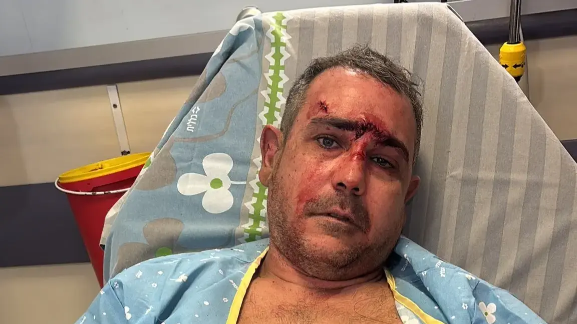 בן אביטל שנפצע מנפילת רסיס, אילת בן אביטל שנפצע מנפילת רסיס, אילת