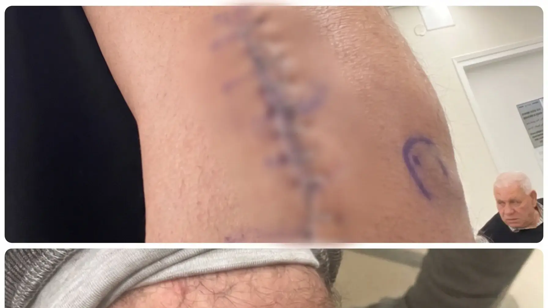 פציעותיו של נור מהאירוע פציעותיו של נור מהאירוע