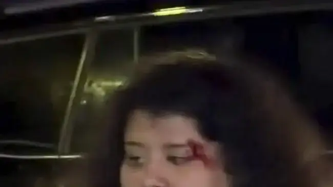 שתי נשים הולכות מכות ברחוב שתי נשים הולכות מכות ברחוב